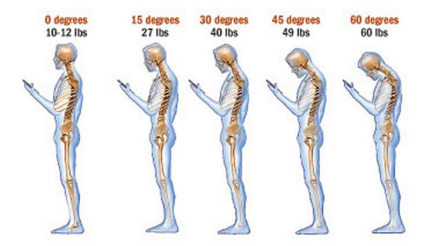 Does Field Hockey Hurt Your Back?: Expert Insights and Tips